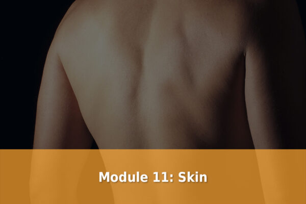 Module 11 Skin